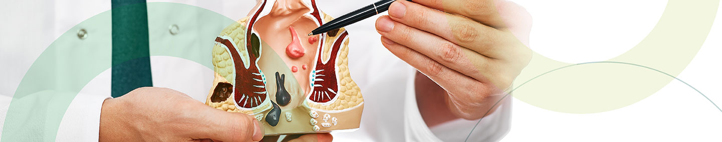 Manejo-de-IVC-en-paciente-con-DM.jpg